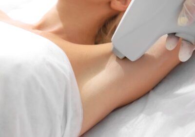 Qu’est-ce que l’épilation au laser ?